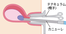 吸引