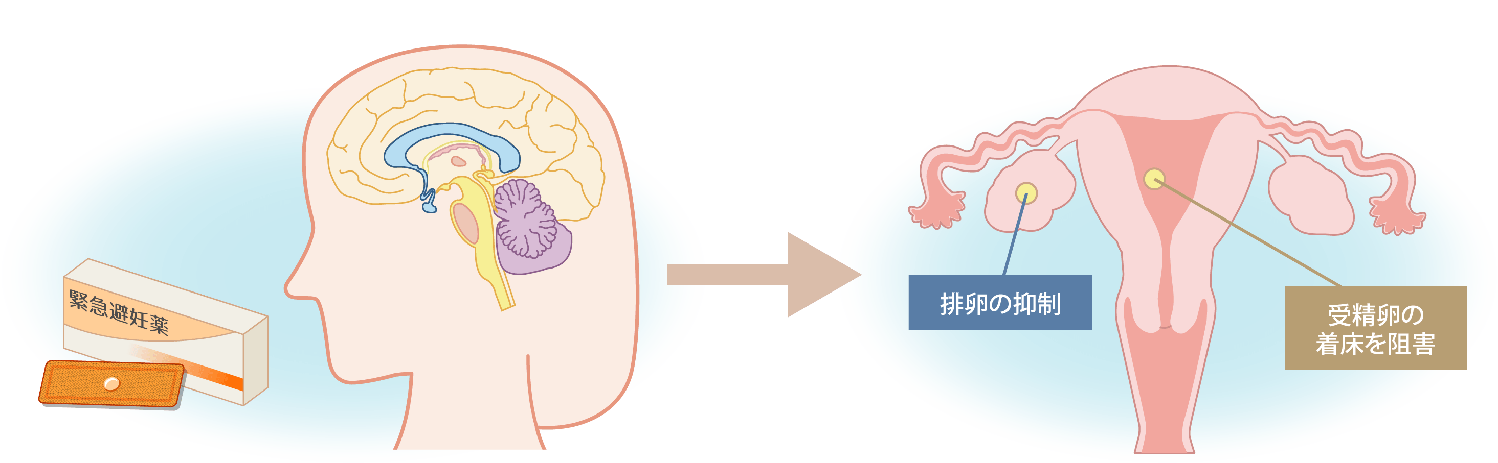 緊急避妊ピル