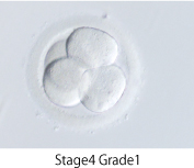卵子や胚の観察・グレーディング