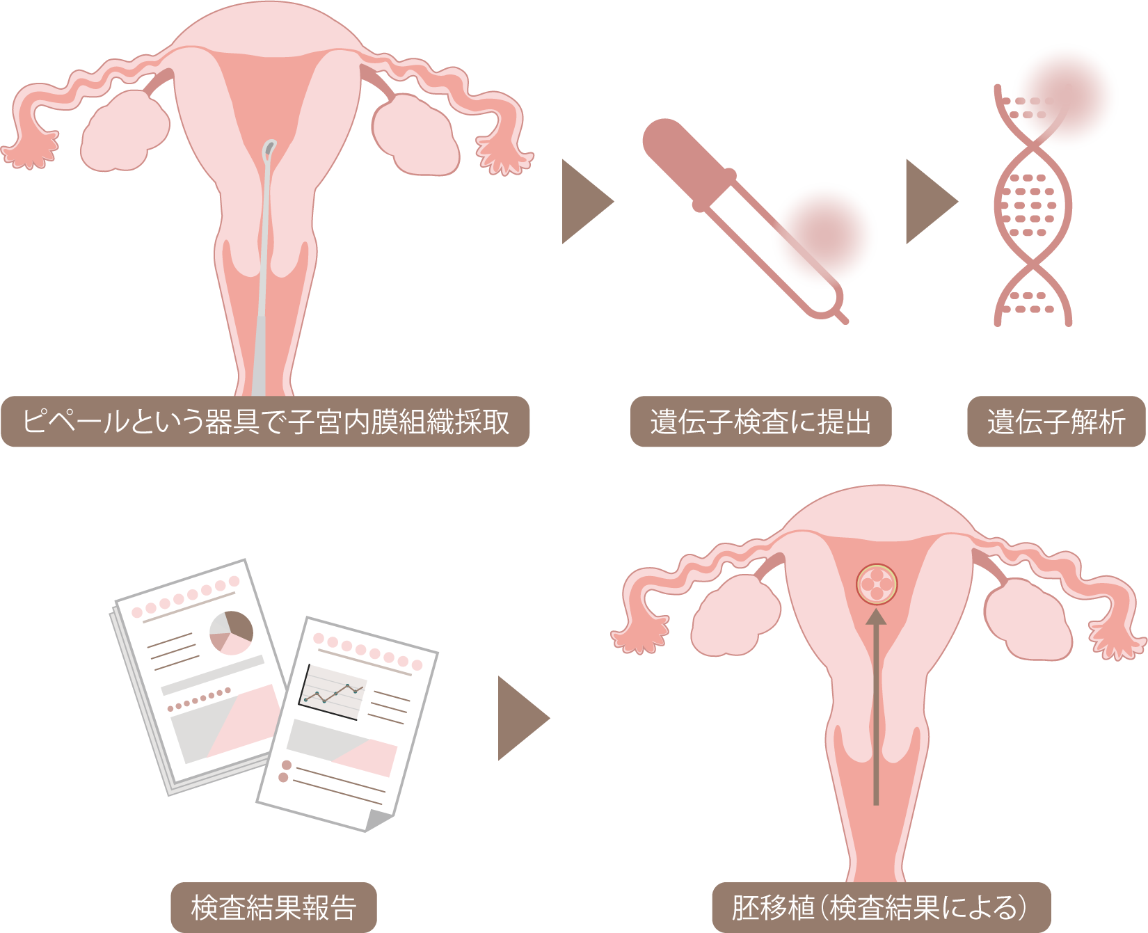 ERA検査イメージ