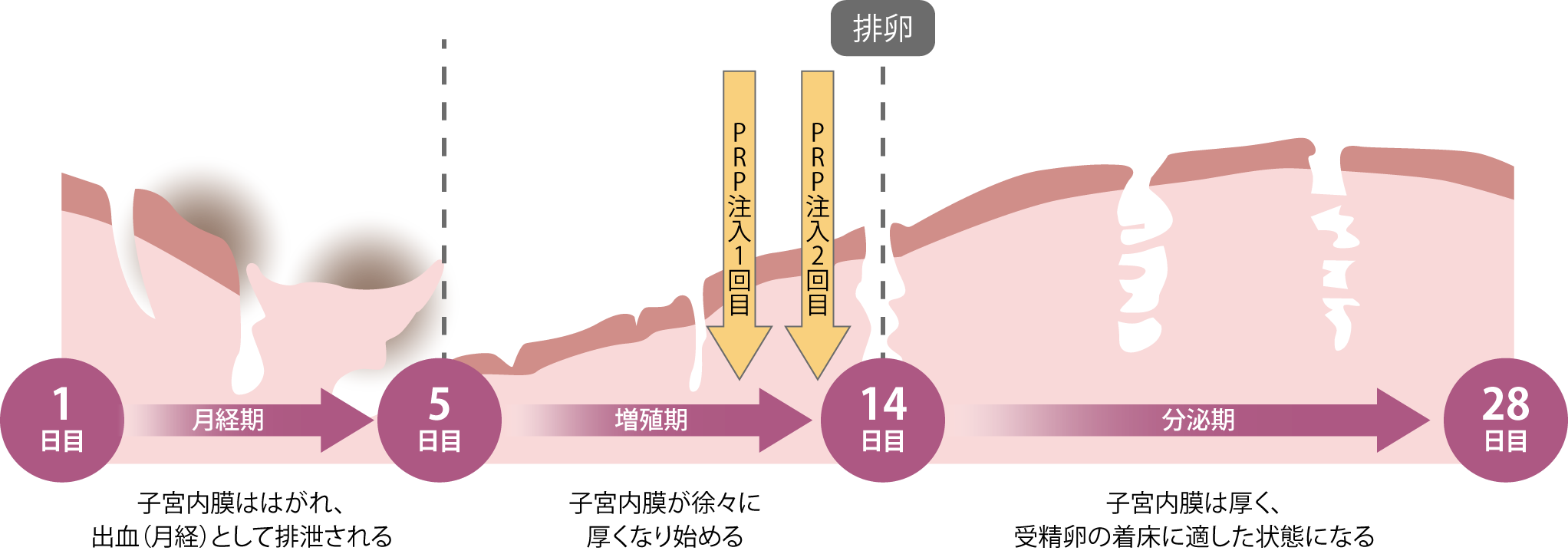 PRP療法とは・イメージ