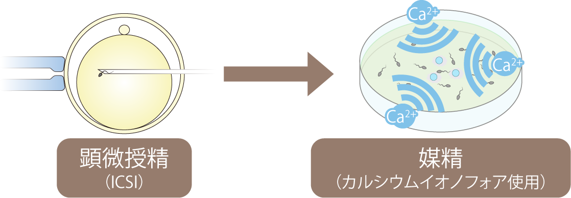 カルシウムイオノフォア受精