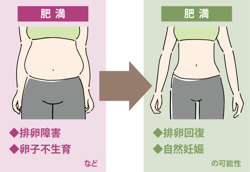 肥満が原因で不妊の可能性がある