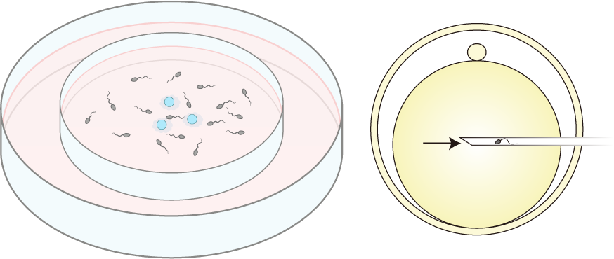 受精法イメージ