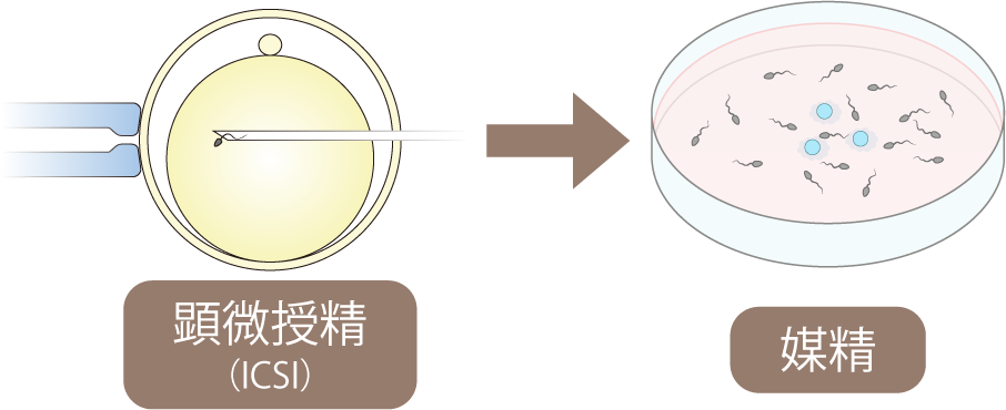 通常の顕微受精