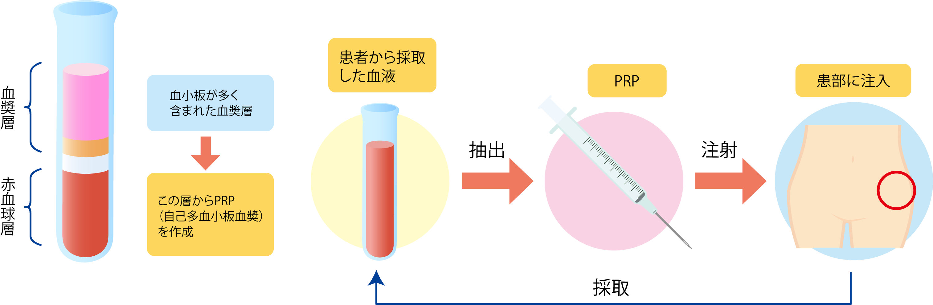 PRP療法の原理・イメージ