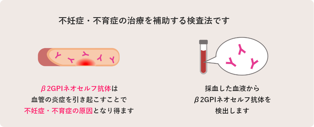 不妊症・不育症の治療を補助する検査法です