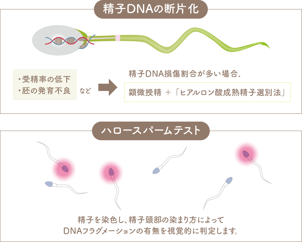 精子DNAにダメージのある場合