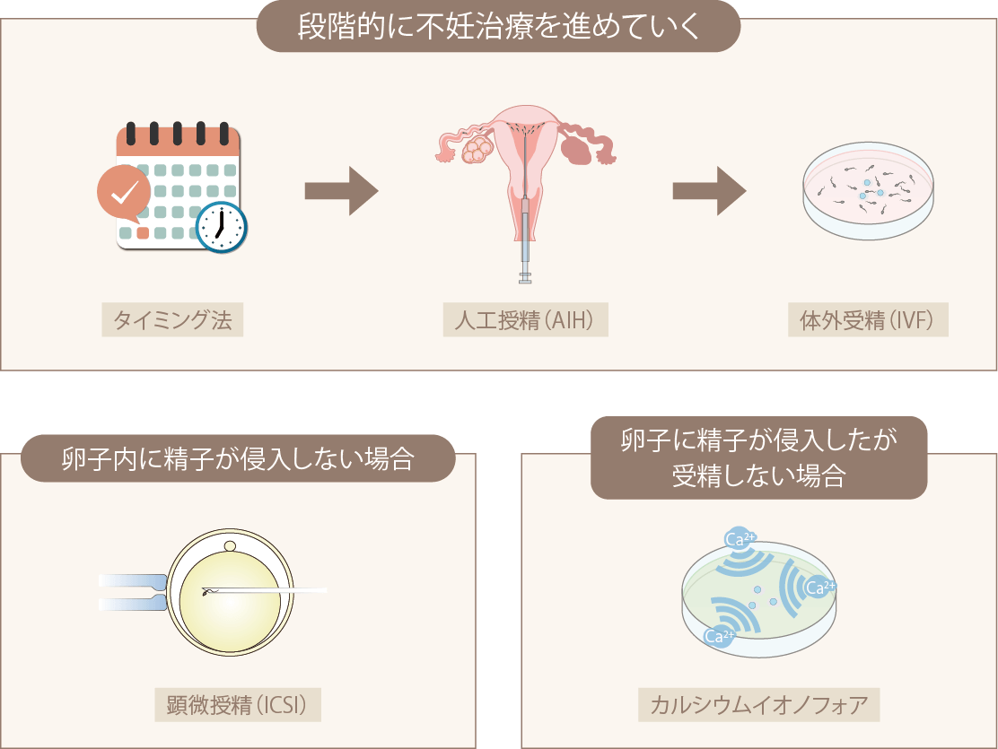 段階的に不妊治療を行う