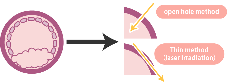 A case where the clear zone is hardened