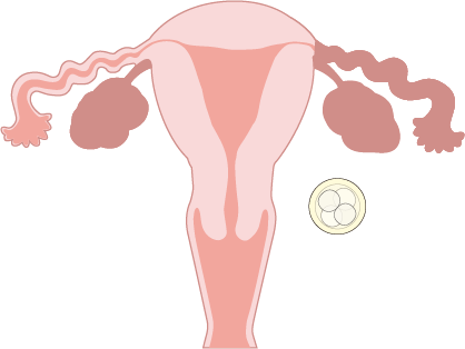 Embryo Transfer