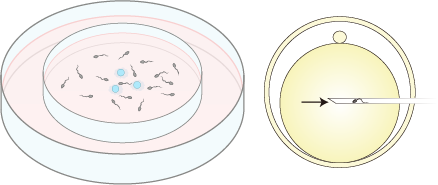 Fertilization Method