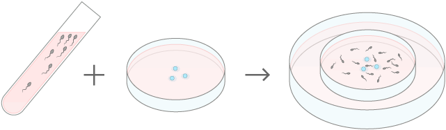 Conventional IVF