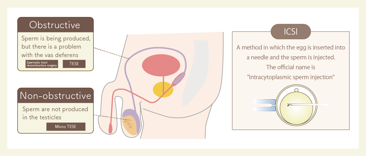 Azoospermia