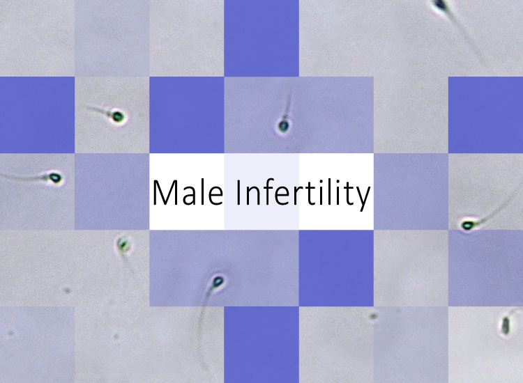 Male Infertility