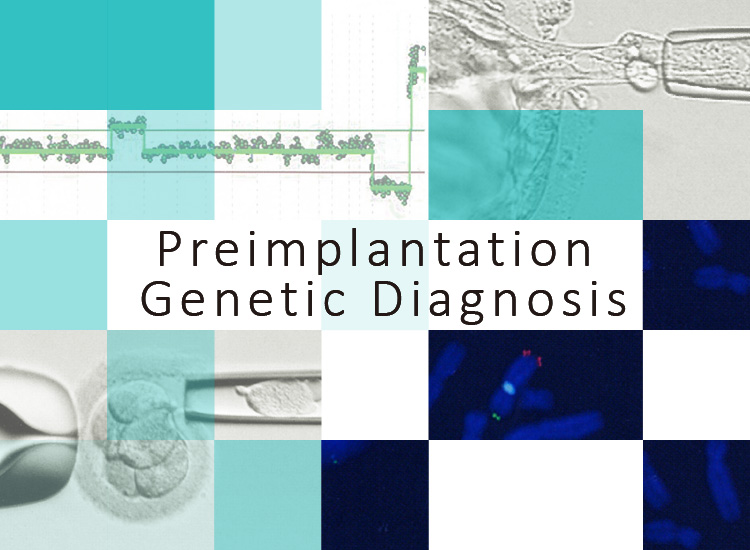 PGD (Preimplantation Genetic Diagnosis)