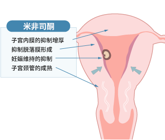 米非司酮片