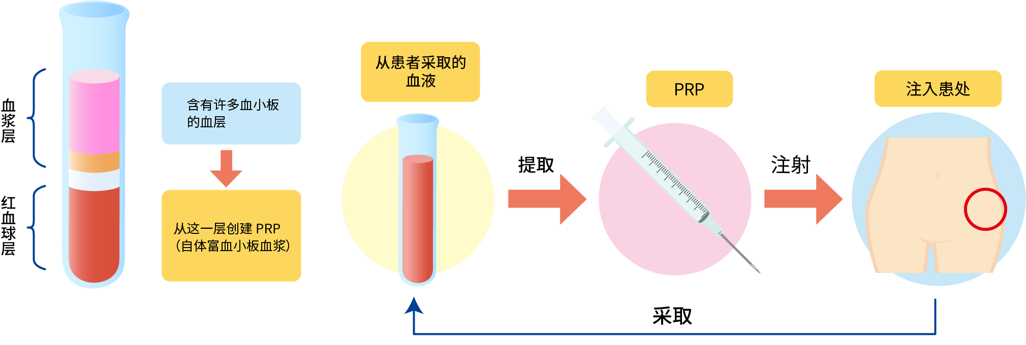 富血小板血浆疗法（PRP）的原理