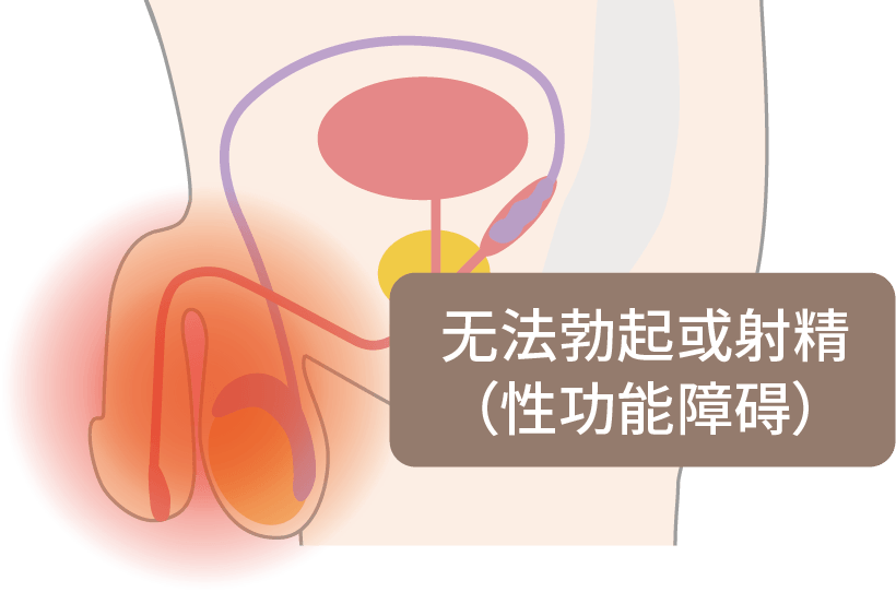 无精液排出